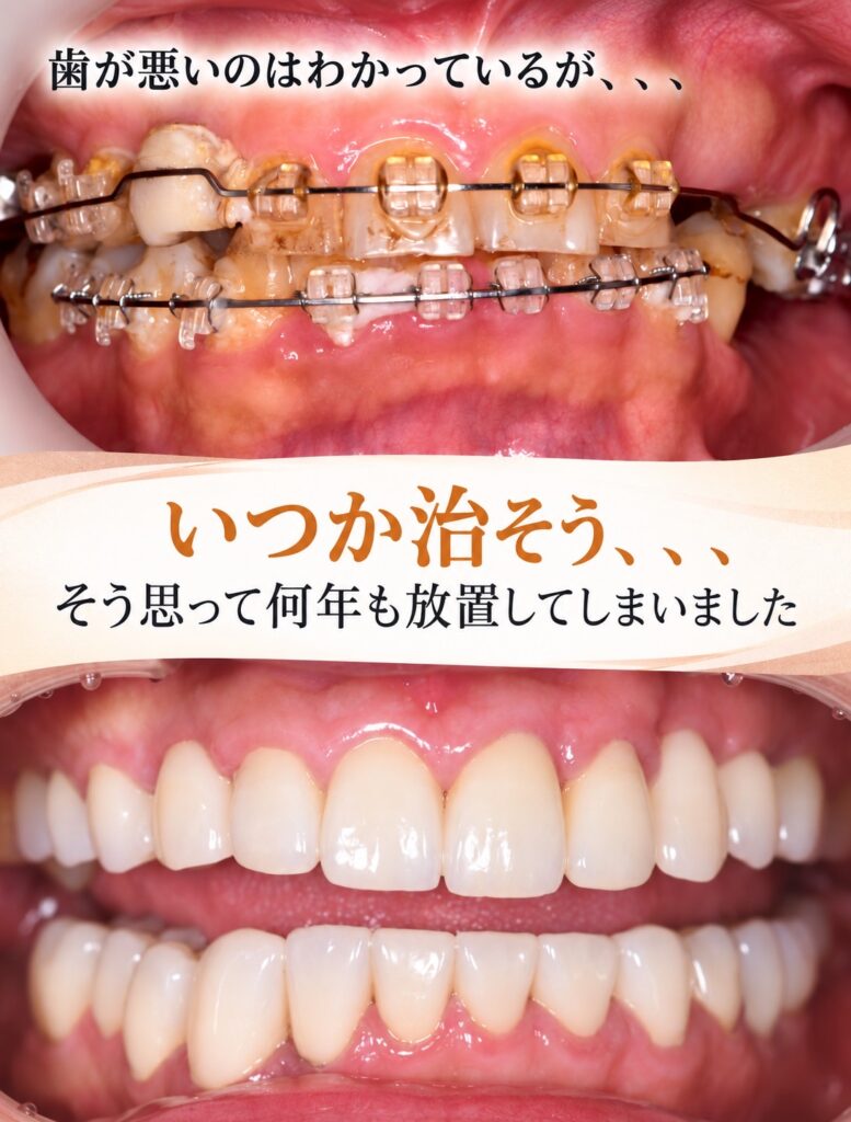 歯医者が怖かった私が治療を最後まで続けられた理由