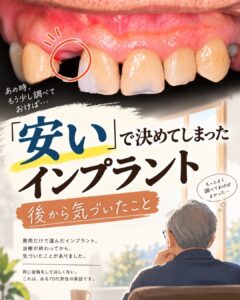インプラントは「安さ」で決めていい？70代男性の体験談